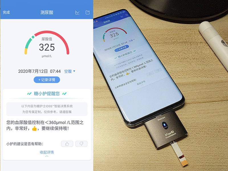 小米有品推出智能检测仪，一机双测，智能管理，网友：贴心小护士